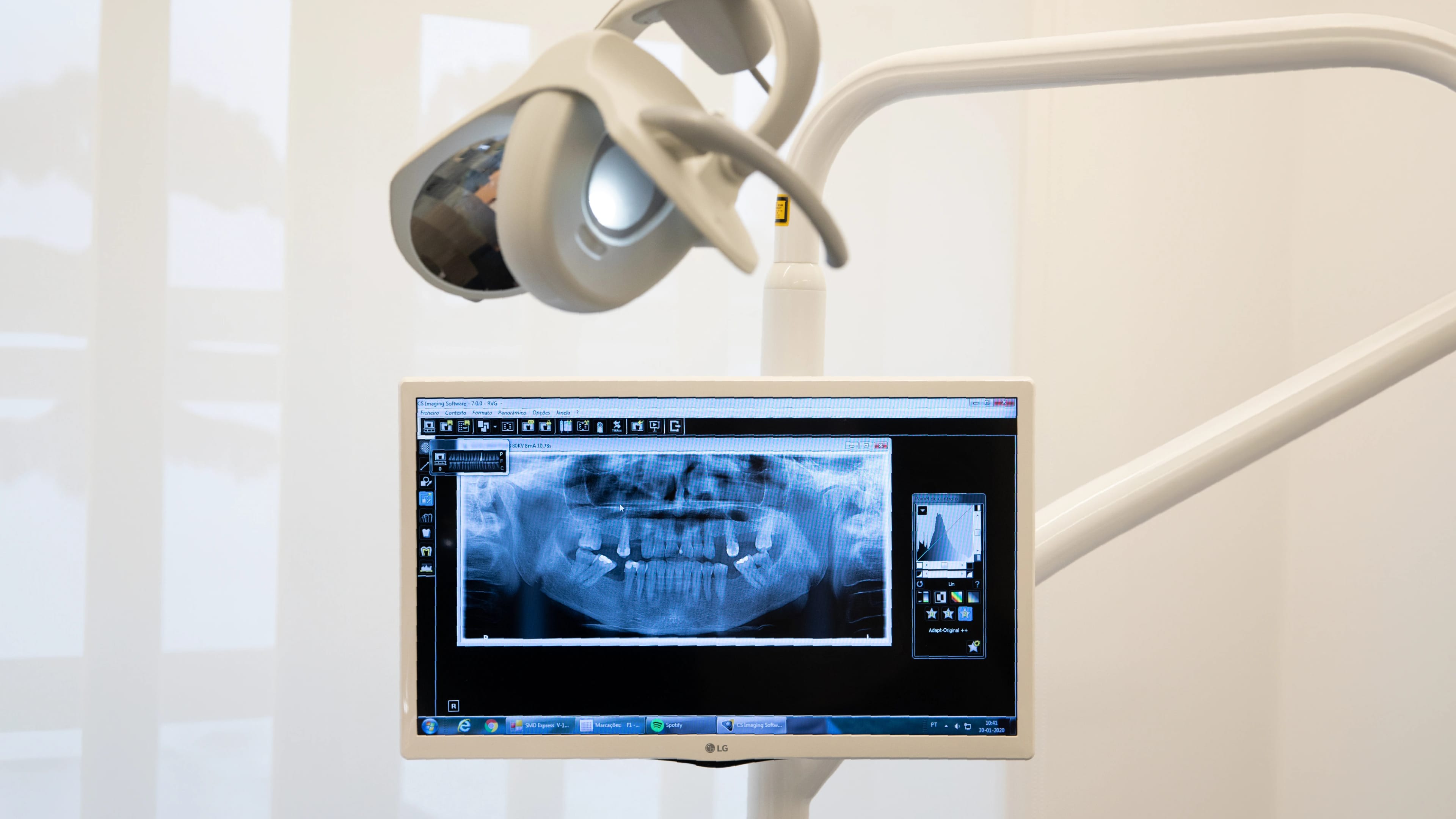 Implantologia: Recupere o seu sorriso através da técnica All-On-4