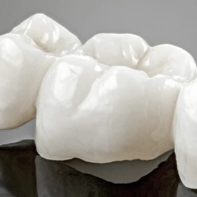 Coroa dentária
