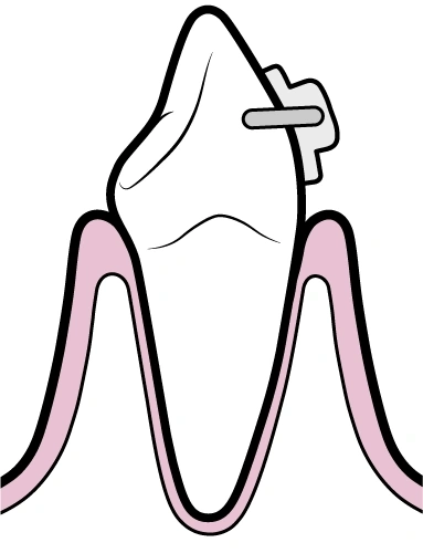 Ortodontia | Carreira Dental Clinic Ortodontia