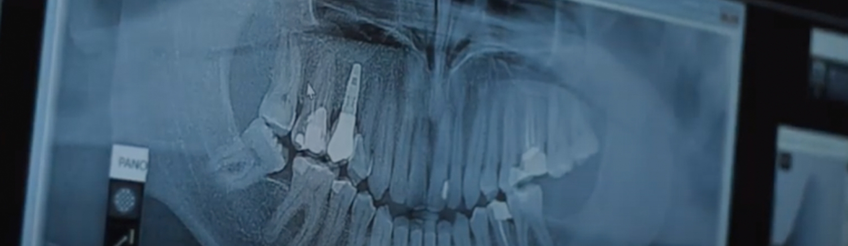 Serviço de Implantologia - Raio X clínica dentária