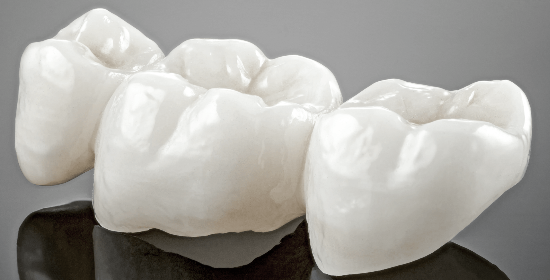 <h2><b>O que são<br/> Coroas Dentárias?</b></h2>