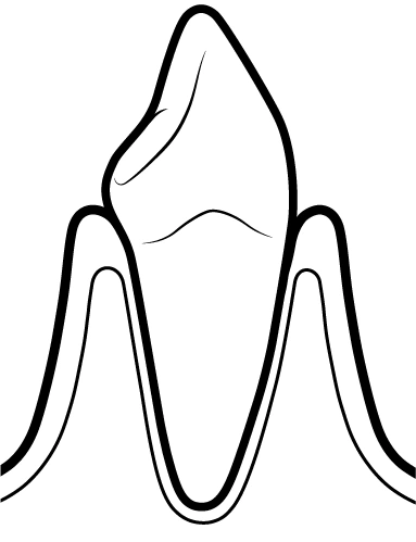 Odontopediatria | Carreira Dental Clinic Odontopediatria