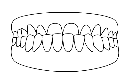 Prognatismo | Carreira Dental Clinic Prognatismo