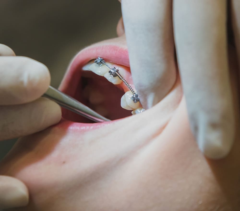 Serviço de ortodontia