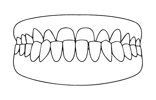 Prognatismo | Carreira Dental Clinic Prognatismo